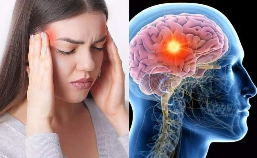 ब्रेन ट्युमरका १० सामान्य लक्षणहरु